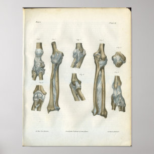Gelenke des Ellbogen-u. Arm-Anatomie-Druckes Poster
