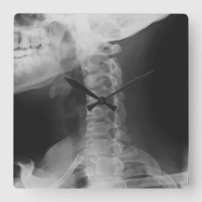 Geröntgte 2 quadratische wanduhr (Vorderseite)
