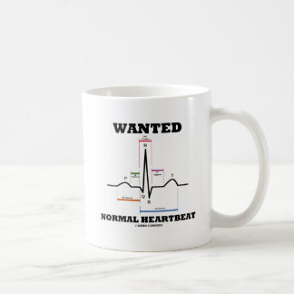 Gewollt normaler Herzschlag (Elektrokardiogramm) Tasse