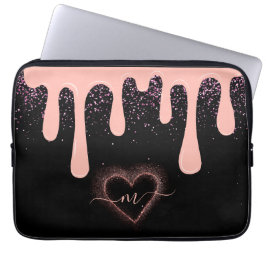 Girl Blush Pink Paint Tropfen Glitzer Mit Monogram Laptopschutzhülle