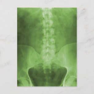 Green Digital X-Ray Art Postkarten