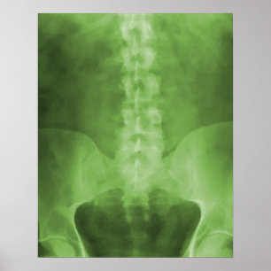 Green Digital X-Ray Art Print Poster