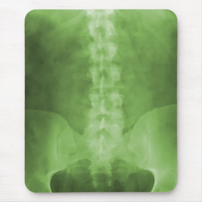 Grüne Digital-Röntgenstrahl-Kunst Mousepad (Vorne)