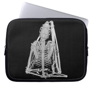 Gruseliges gotisches Schläger-Skelett Laptopschutzhülle