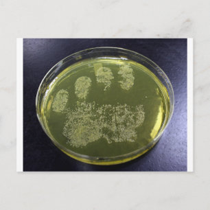 Hand Petri Dish Bacteria Postkarte