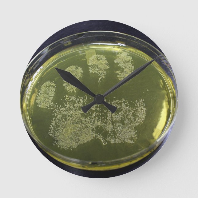 Hand Petri Dish Bacteria Runde Wanduhr (Vorderseite)