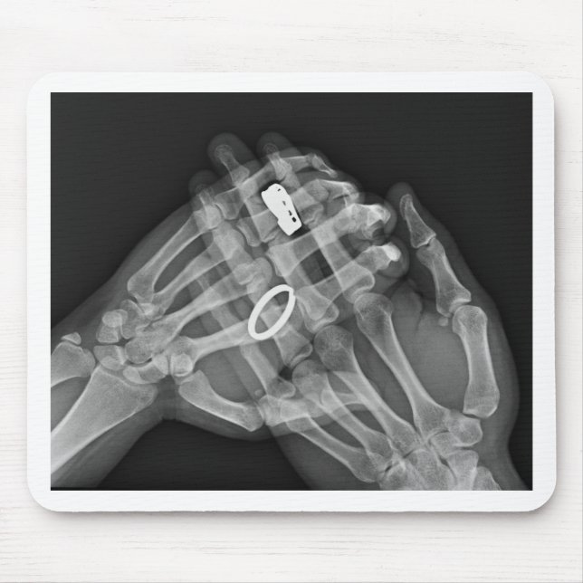Handholding Mousepad (Vorne)