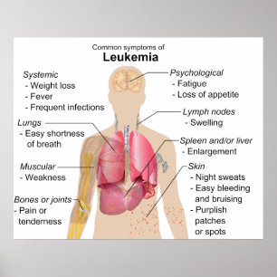 Häufige Symptomatik Leukämie Blutkrebs Poster