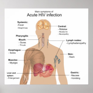 Hauptsymptome der akuten HIV-Infektion Poster