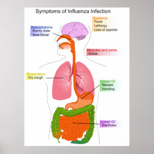 Hauptsymptome eines Influenza-Infektionsdiagramms Poster