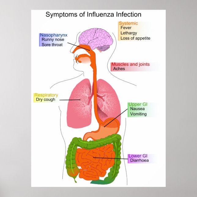 Hauptsymptome eines Influenza-Infektionsdiagramms Poster (Vorne)