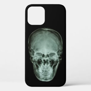 Head Skull X-Ray Case-Mate iPhone Hülle