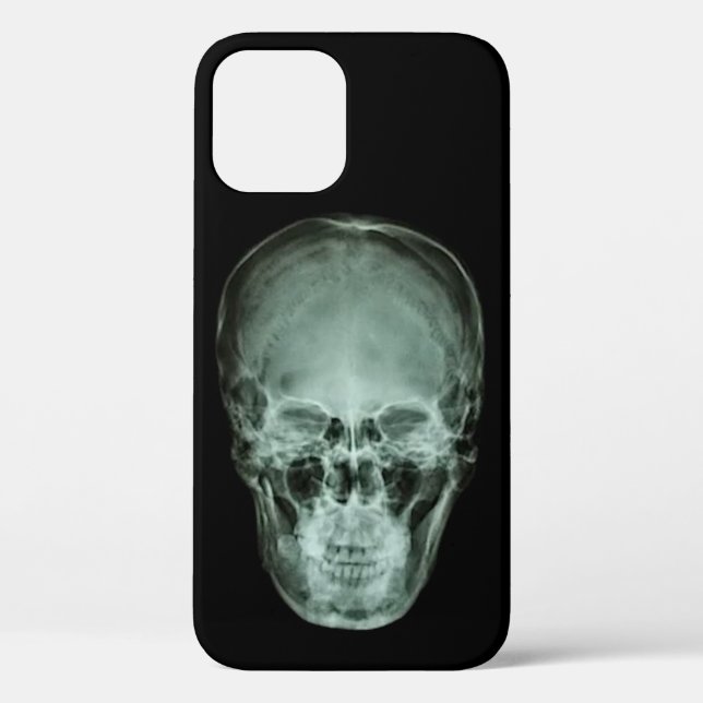 Head Skull X-Ray Case-Mate iPhone Hülle (Rückseite)
