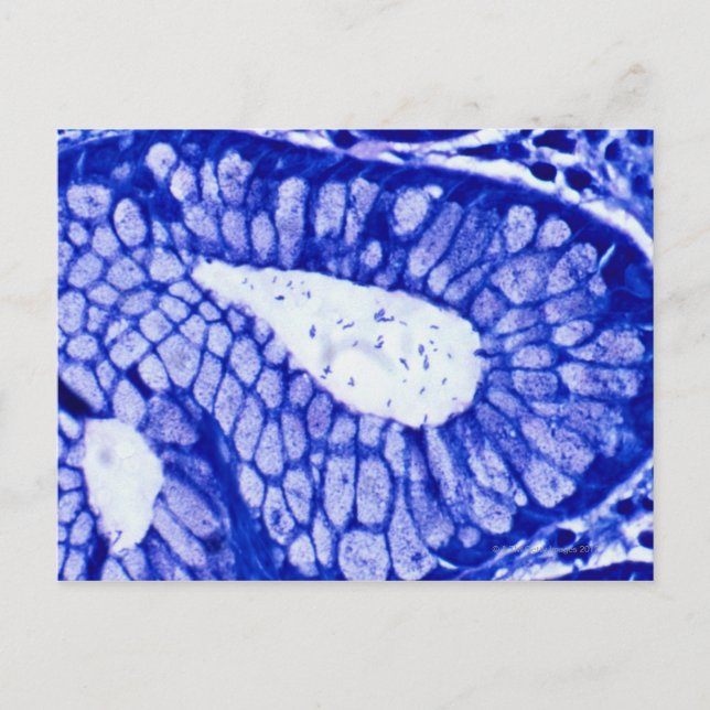 Helicobacter Pylori Postkarte (Vorderseite)
