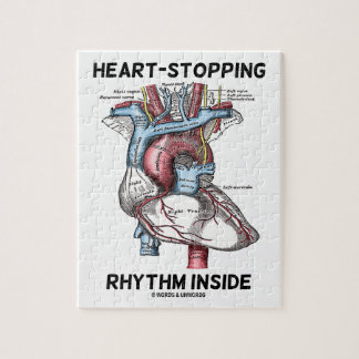 Herz-Stoppen des Rhythmus innerhalb des Puzzle