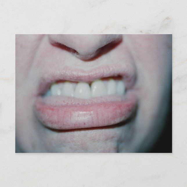 Heute kein Lächeln Postkarte (Vorderseite)