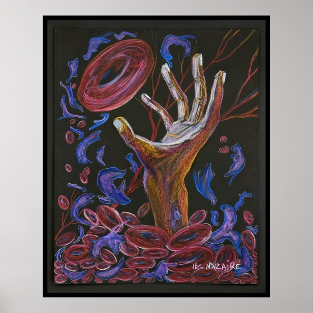 Hope - Sickle Cell Art Print Poster (Vorne)