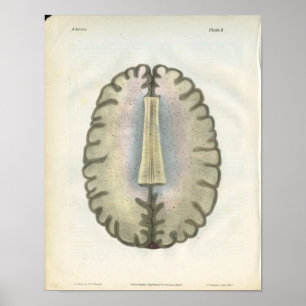 Human Brain Anatomy Print Poster