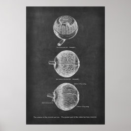Human Eye Anatomy Arteries of the Choroid & Iris Poster