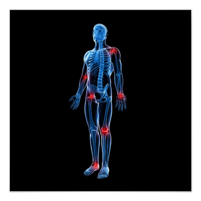 Human Xray Poster (Vorderseite)