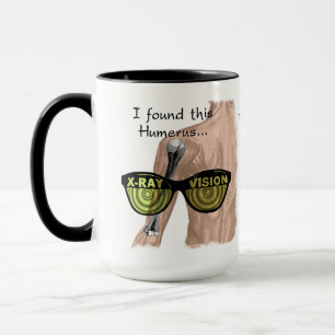 Humurer Humerus Funny Medical Personalisiert Tasse