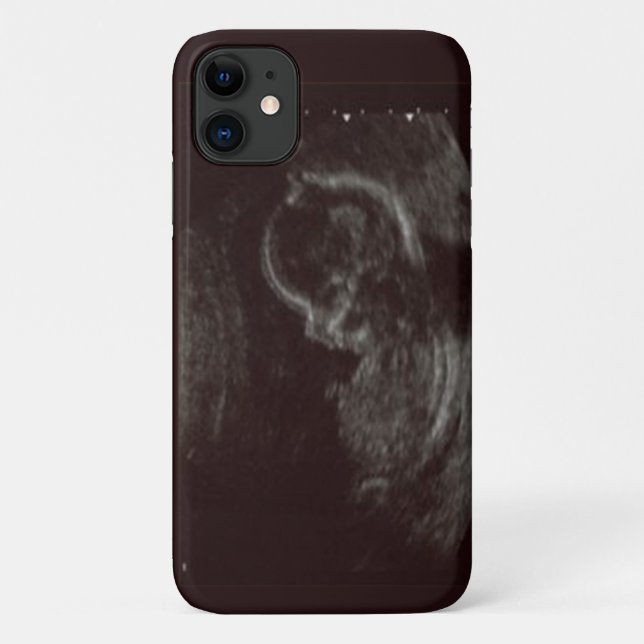 Ihr Babys Ultrasound Foto Case-Mate iPhone Hülle (Rückseite)