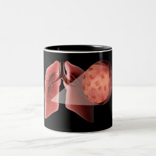 Inflammed Fluglinie während eines Asthmaanfalls Zweifarbige Tasse