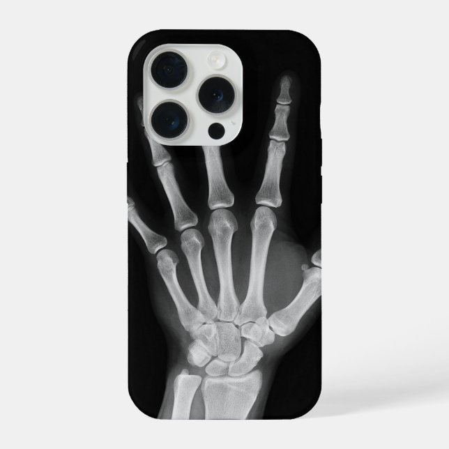 iPhone 15 Pro Hülle Skeleton (Rückseite)
