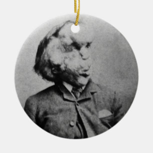 Joseph "John" Merrick Der Elefantenmann von 1889 Keramikornament