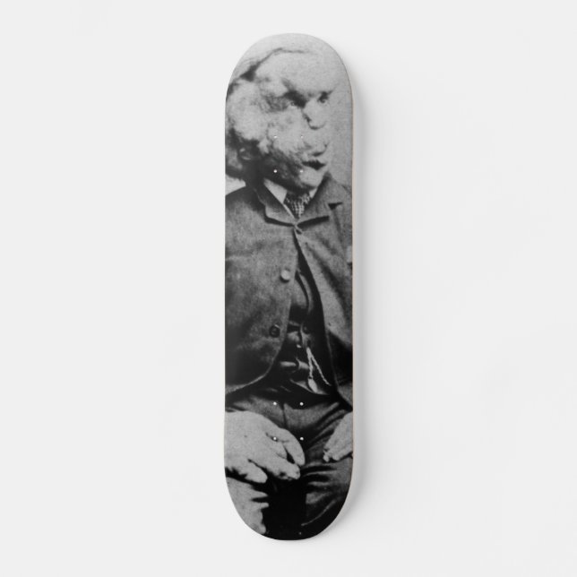 Joseph "John" Merrick Elephant Man ab 1889 Skateboard (Vorderseite)