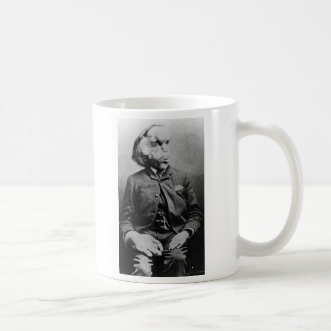 Joseph "John" Merrick Elephant Man ab 1889 Tasse (Rechts)