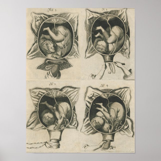 Justine Siegemund Court Midwomen Birth Pregnancy Poster (Vorne)