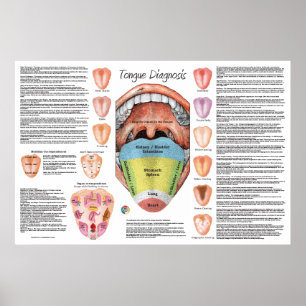Karte zur Diagnose der ayurvedischen Tongue Poster