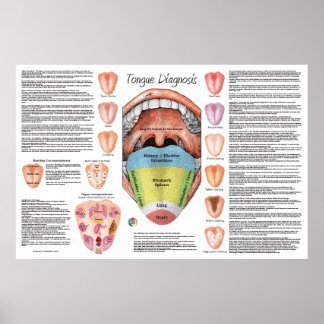 Karte zur Diagnose der ayurvedischen Tongue Poster