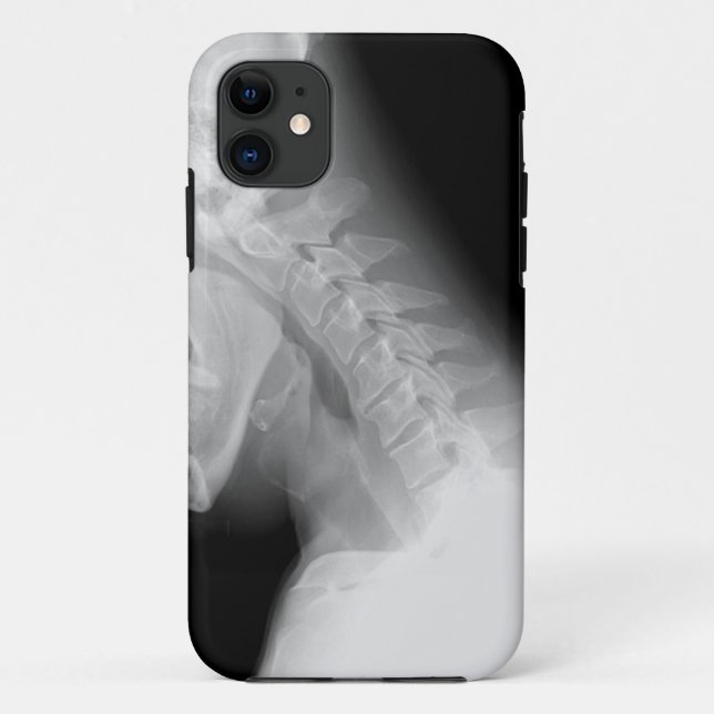Kiefer-und des Dorn-X Strahl IPhone Fall Case-Mate iPhone Hülle (Rückseite)