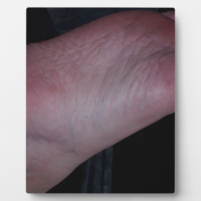 KLICKEN SIE JETZT AUF MEINEN FUSS! FOTOPLATTE (Vorderseite)