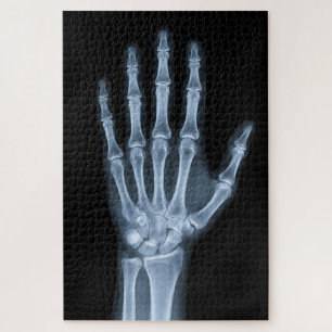 Klinische Röntgenaufnahme der Hand Puzzle