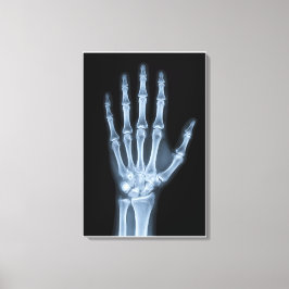 Klinisches Röntgenbild der Hand Leinwanddruck