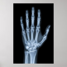 Klinisches Röntgenbild der Hand