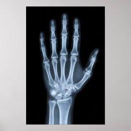 Klinisches Röntgenbild der Hand Poster