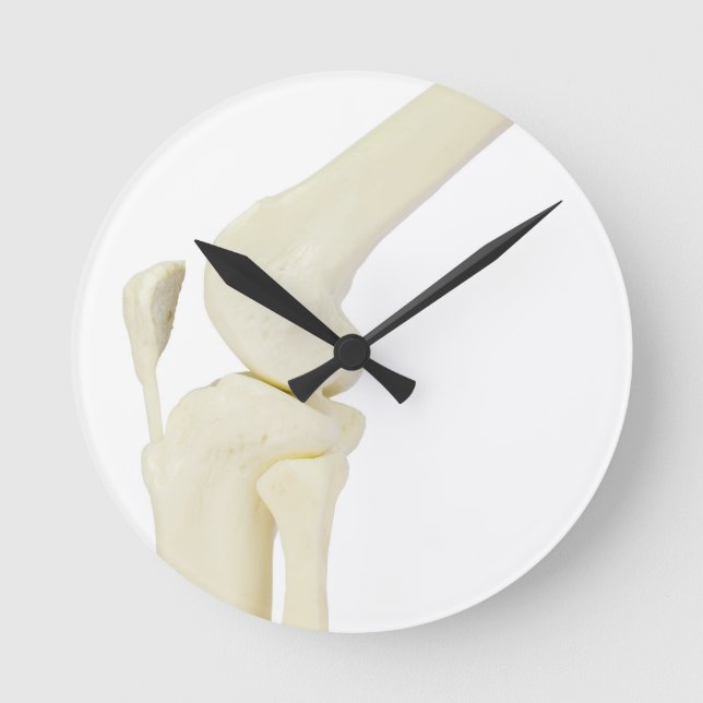 Knee joint model of human leg runde wanduhr (Vorderseite)