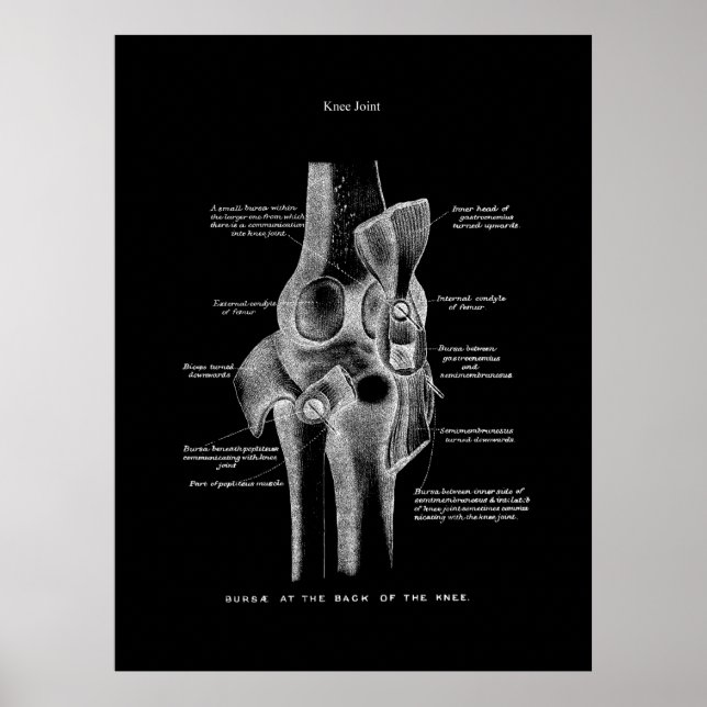 Kniegelenke Anatomie Kunst Poster (Vorne)