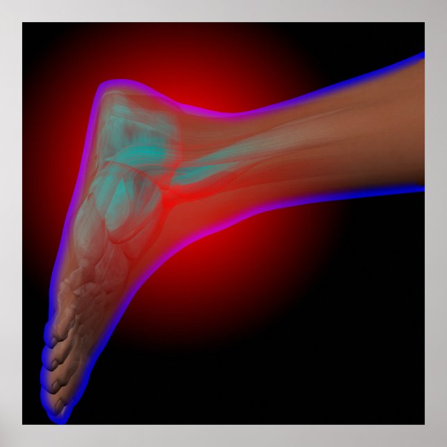 Knöchelschmerzen Poster (Vorne)