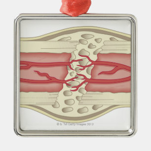 Knochen, der 2 sich repariert ornament aus metall