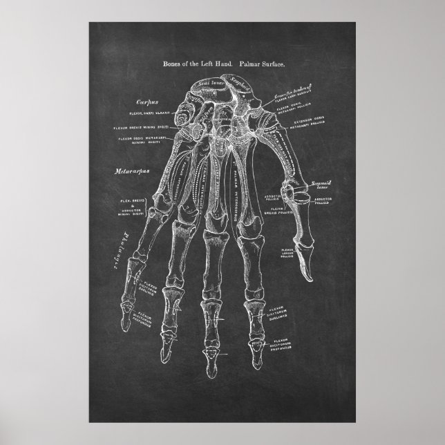 Knochen der Links Hand Palmar Oberflächenanatomie Poster (Vorne)