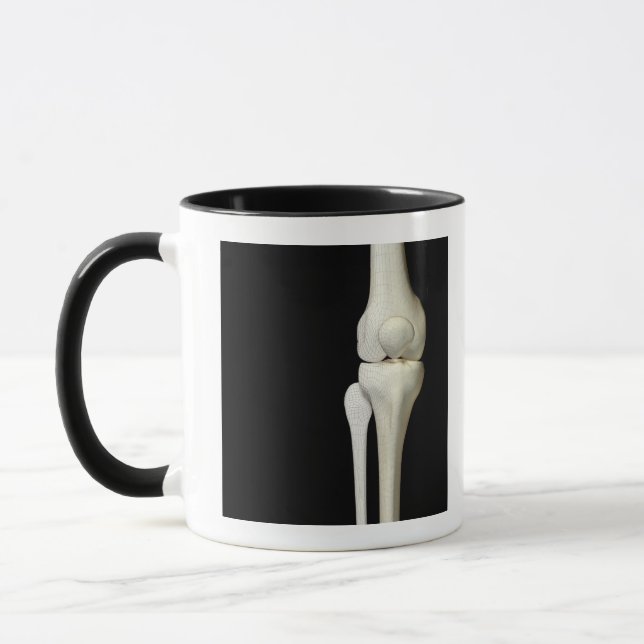 Knochen des Knies 4 Tasse (Links)