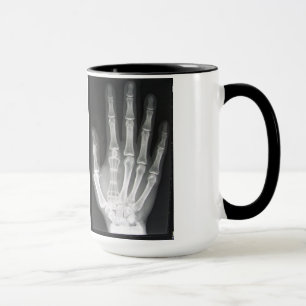 Königin im Handröntgenstrahl Tasse