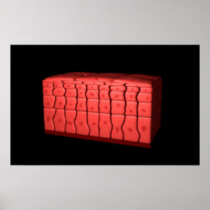 Konzept des ratifizierten Plattenepithels 2 Poster