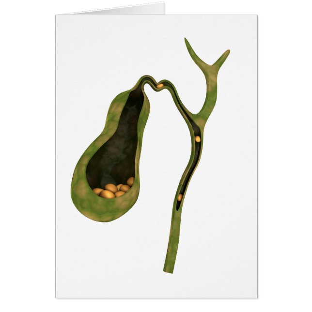 Konzeptbild von Gallstones im Gall (Vorne)