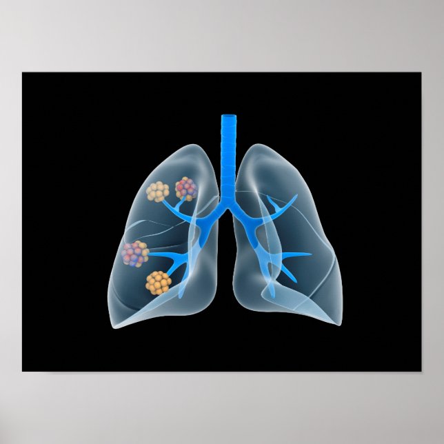 Konzeptuelles Bild des menschlichen Herzens 4 Poster (Vorne)